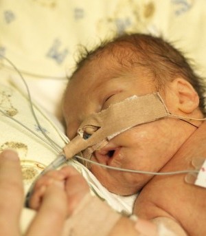 Early delivery comes with risk for babies