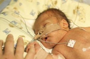 Early delivery comes with risk for babies