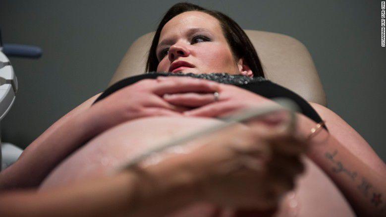 Stopping the opioid crisis in the womb