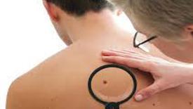 Pale is the new tan: Slip. Slop. Slap. Seek. Slip. See.