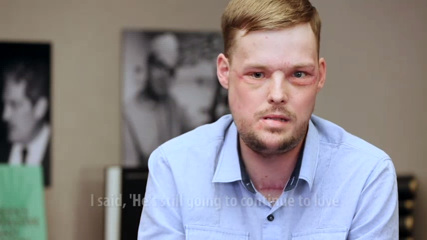 Face transplant links men touched by tragedy