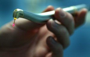 Going Jedi on your teeth: Lasers at the dentist's office 