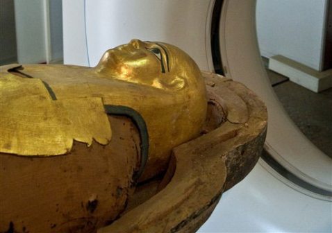 Don't blame fast food: Mummies had heart disease 