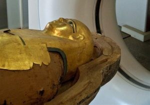 Don't blame fast food: Mummies had heart disease 