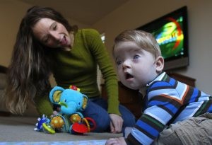 Surgery relieves infant’s skull condition 