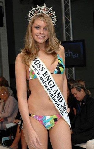 Miss England told to fatten up 
