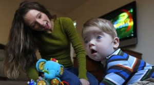 Surgery relieves infant’s skull condition 