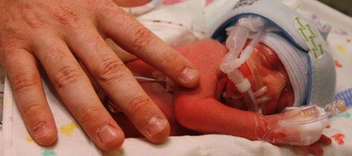 Cluff quadruplets of Gilbert are born 