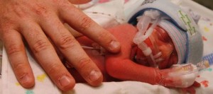 Cluff quadruplets of Gilbert are born 