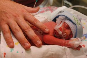 Cluff quadruplets of Gilbert are born 