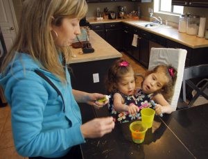 Conjoined twins could make medical history 