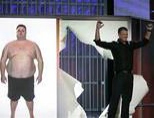 NBC's 'Biggest Loser' considered surgery 