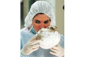 For forensic anthropologist, each set of remains is a puzzle to be solved 