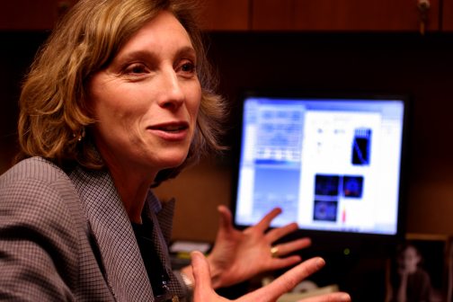 Computers closing in on Alzheimer's diagnosis 
