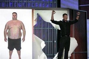NBC's 'Biggest Loser' considered surgery 