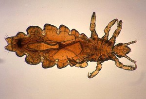 kuna closes elementary school after lice outbreak idaho press lice outbreak closes school in idaho are lice becoming stronger 300x204 kuna closes elementary school after lice outbreak idaho press lice outbreak closes school in idaho are lice becoming stronger 300x204