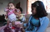 Birth control, epidurals and hospital admissions  