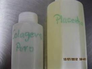 placenta labeled