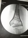 St. Francis de Sales' Bober makes a great recovery