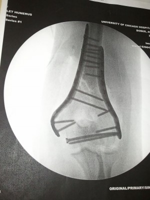 St. Francis de Sales' Bober makes a great recovery