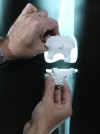 Advances in knee replacement lead to more precise surgery