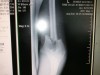 Bober_XRay_1.jpg