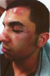 Lake Central School Corp. sued over beating of student by other students