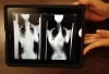 Surgical technology provides 'GPS' in Methodist operating room