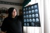 Dealing with a rare disease
