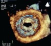Porter uses diagnostic cardiology to help take care of patients