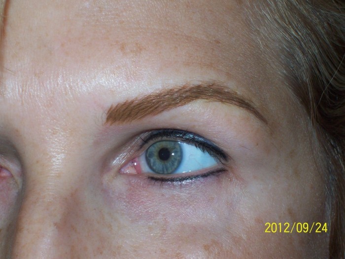 Brows 1