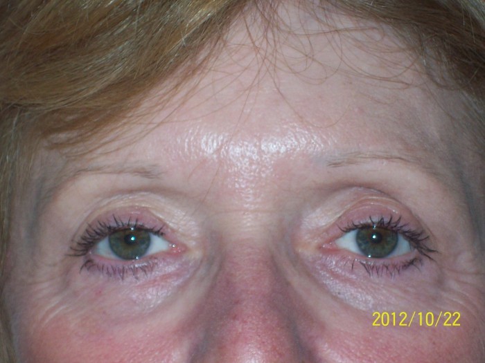 Brows 3