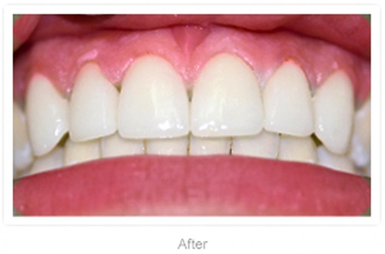 Hollywood Smile Dental will make your teeth sparkle  2