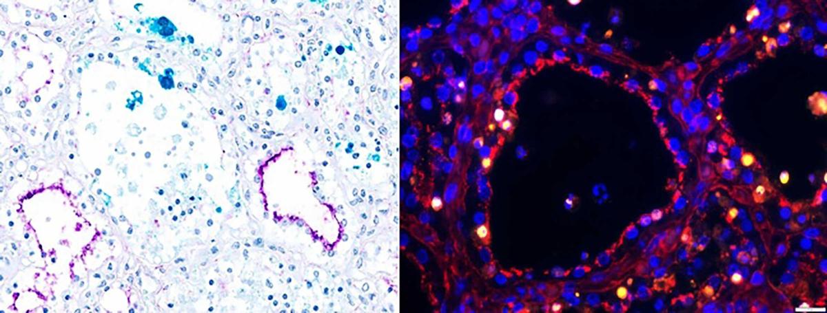 Microscope images of mammary gland tissue