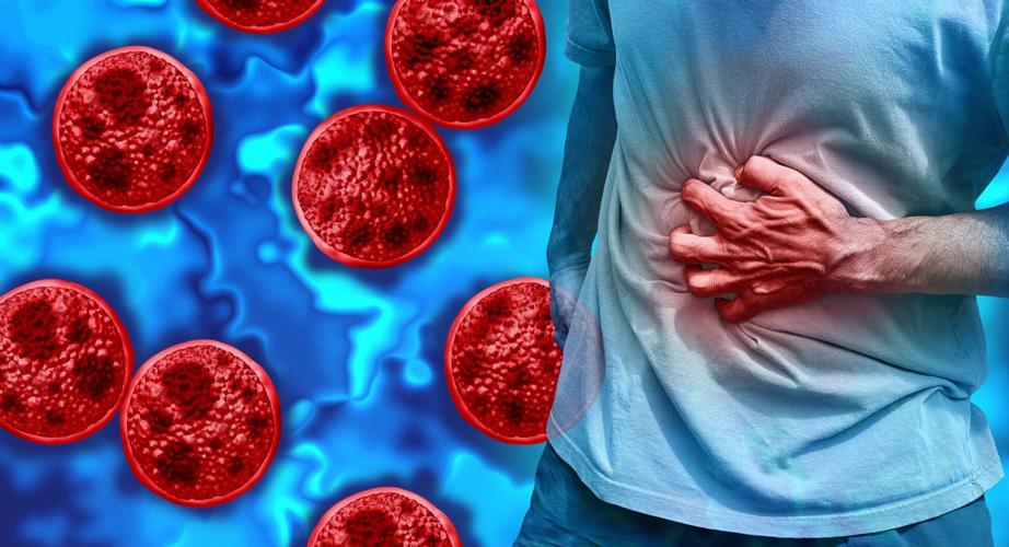 Cyclosporiasis disease outbreak