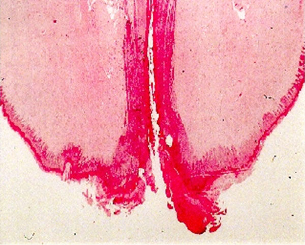 Extreme close-up of teat end