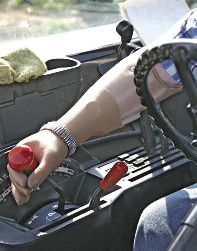 Prosthetic arm