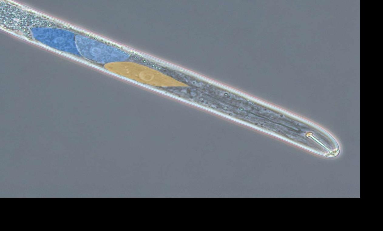 Cyst nematode through microscope