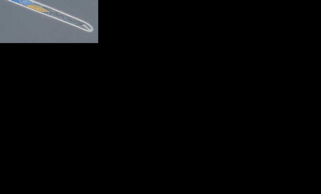 Cyst nematode through microscope