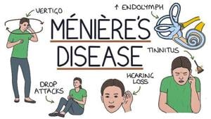 Ménière’s Disease symptoms