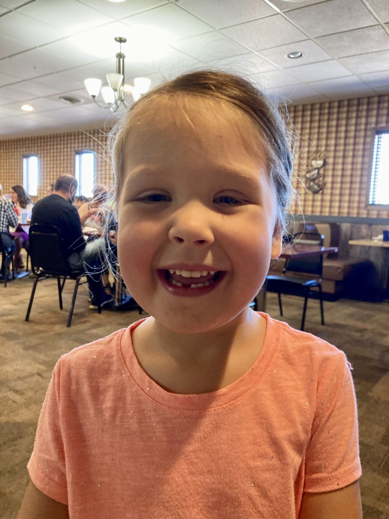 Missing tooth