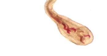 Juvenile root-knot