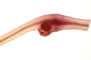 Adult female nematode
