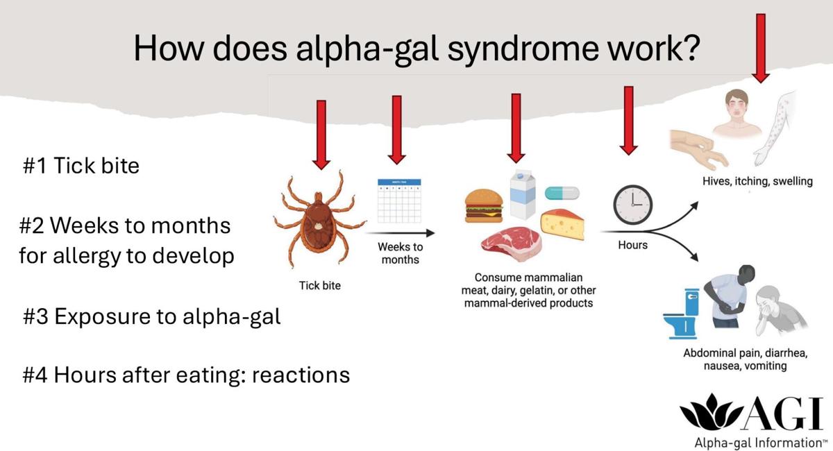 How does alpha-gal syndrome work