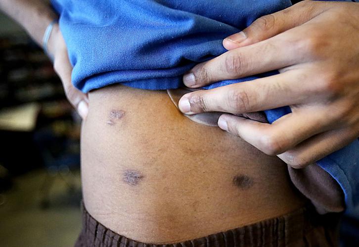 19-year-old inmate gunshot wounds