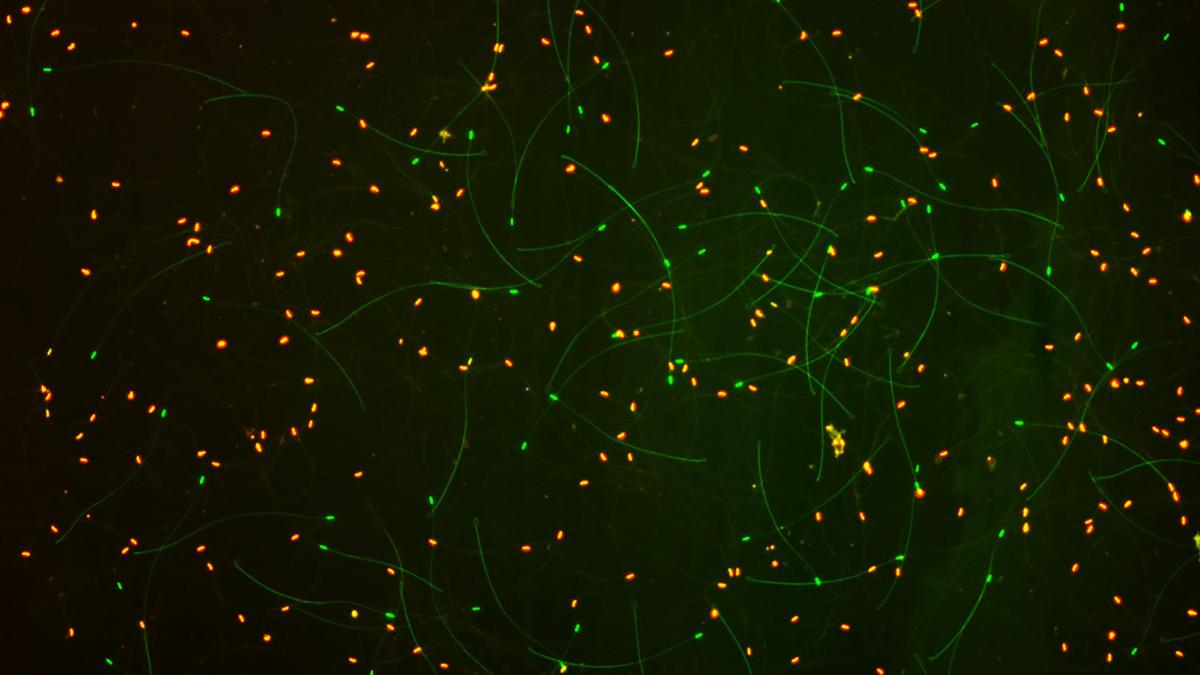 Study Sheds Light On Honey Bee Reproductive Failures Crops Agupdate Com