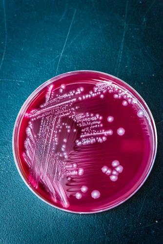 K-State receives patent for vaccine that could protect livestock, make food safer