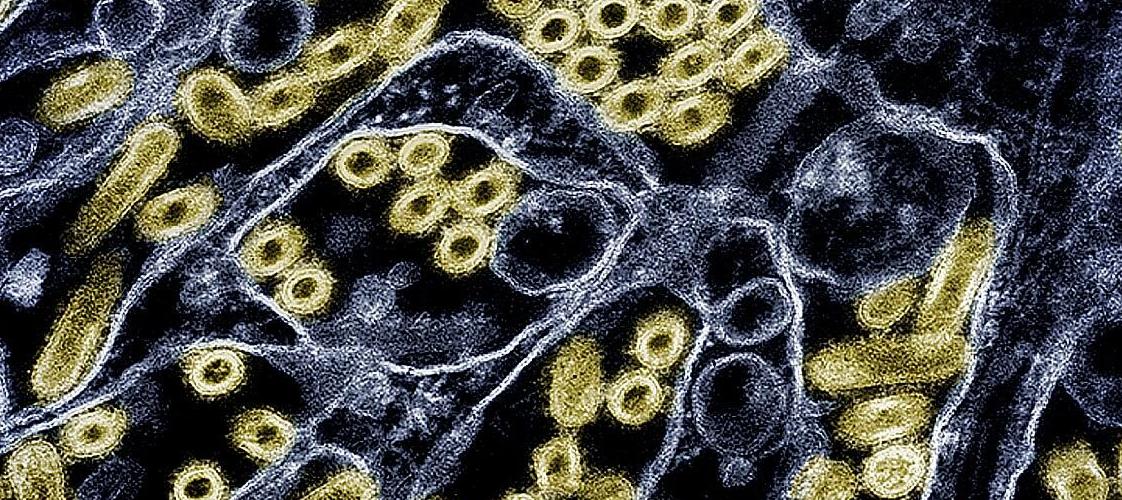 H5N1 virus particles