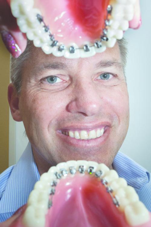 Hidden Braces