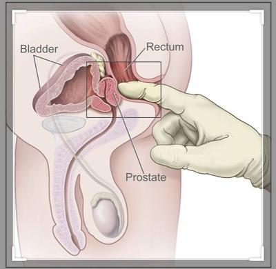 prostate health